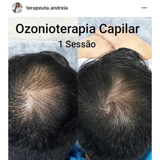 Tratamento capilar 